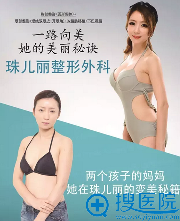 韩国珠儿丽整形面部脂肪填充+双下巴吸脂案例 看辣妈的变美秘籍