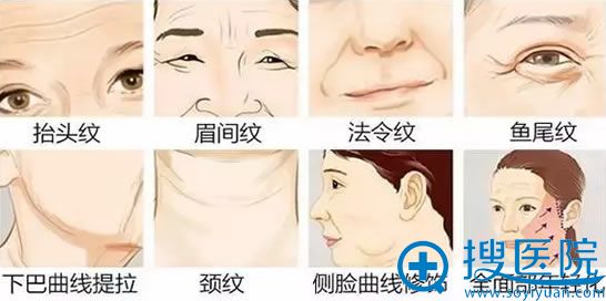 出现各种皱纹示意图 出现各种皱纹示意图