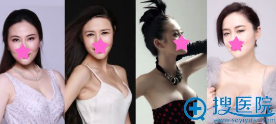 长沙雅美整形四届代言人隆胸案例 长沙雅美整形四届代言人隆胸案例