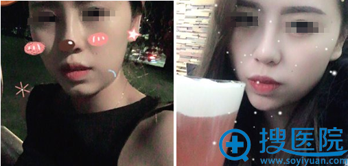 ����������С��<!--<i data=20240710 data-id=16548></i>-->��ʿ�����°�����3���»ָ���