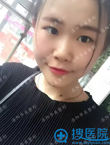 术前照片 术前照片