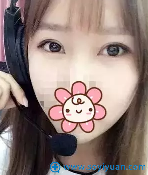 内双妹子割双眼皮术后40天恢复效果 内双妹子割双眼皮术后40天恢复效果