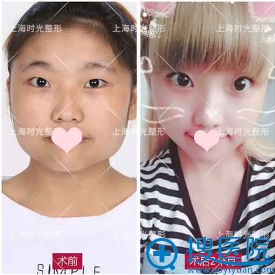 �Ϻ�ʱ��ν���ĥ����ô�� �����������Ҵ��ķ�����С������