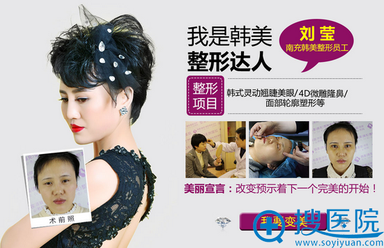 南充韩美双眼皮+隆鼻案例 南充韩美双眼皮+隆鼻案例