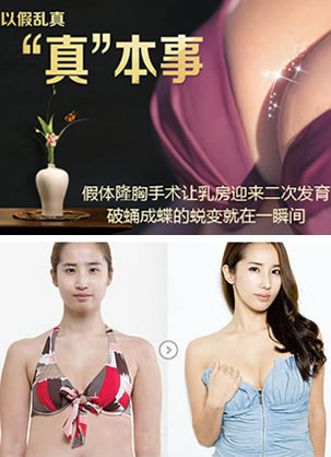邯郸做假体隆胸手术哪家整形医院好?价格多少钱?