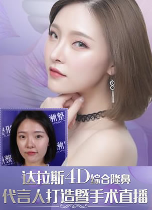 90后姑娘的塌鼻蝶恋之旅 武汉五洲达拉斯4D鼻综合手术直播