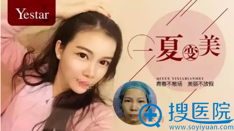 合肥艺星自体脂肪丰额头+太阳穴+下巴案例 还你满满少女感