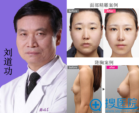 <!--<i data=20240710 data-id=12266></i>-->刘道功隆胸及面部精雕案例 <!--<i data=20240710 data-id=12266></i>-->刘道功隆胸及面部精雕案例