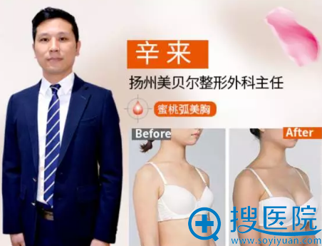 扬州美贝尔整形医生<!--<i data=20240710 data-id=16606></i>-->及医生隆胸案例 扬州美贝尔整形医生<!--<i data=20240710 data-id=16606></i>-->及医生隆胸案例
