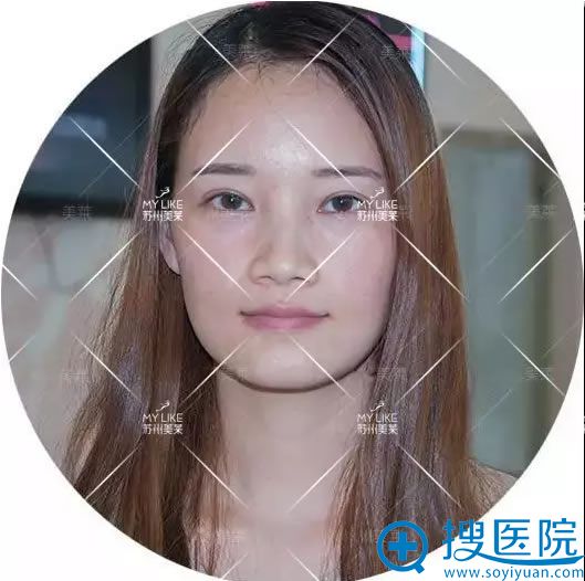 在<!--<i data=20240710 data-id=13583></i>-->整形医院做鼻整形术前照片 在<!--<i data=20240710 data-id=13583></i>-->整形医院做鼻整形术前照片