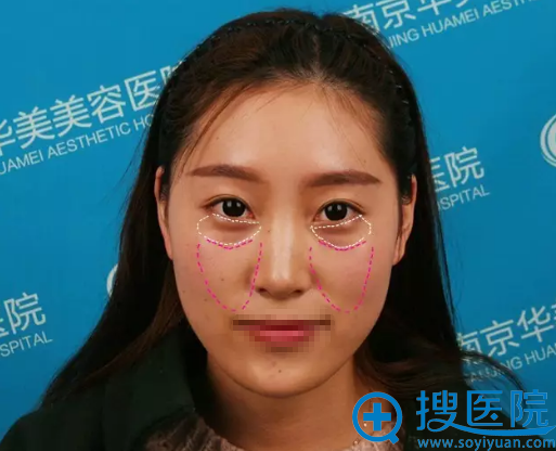 �Ͼ������沿֬�����+����Ч���Ա� ·�˴����ڼ�С��