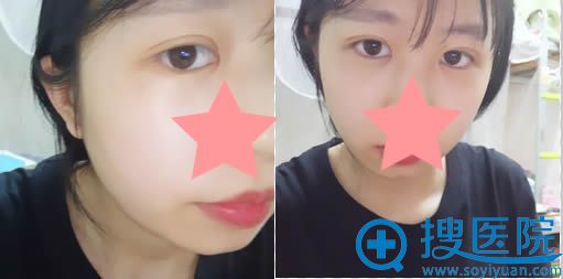 ��˧���п�˫��Ƥ����15��ָ�Ч��