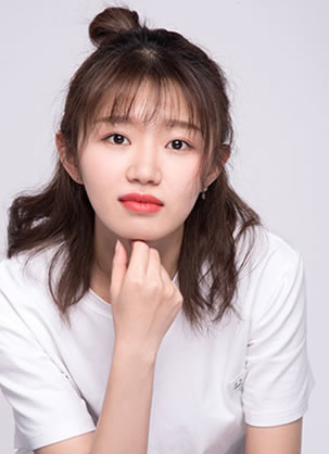 长沙雅美医疗美容田芳斌韩式三点双眼皮案例和30天恢复效果