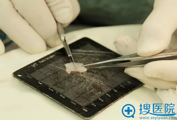 耳软骨+鼻中隔软骨雕刻 耳软骨+鼻中隔软骨雕刻