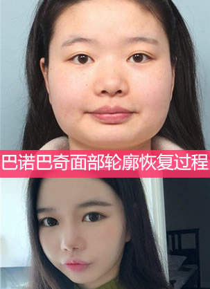 ��ŵ��������ҽԺ�沿����ͯ�������ָ����� 18�����Բ����