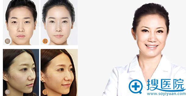 陈媛_北京美莱微整形医生 陈媛_北京美莱微整形医生