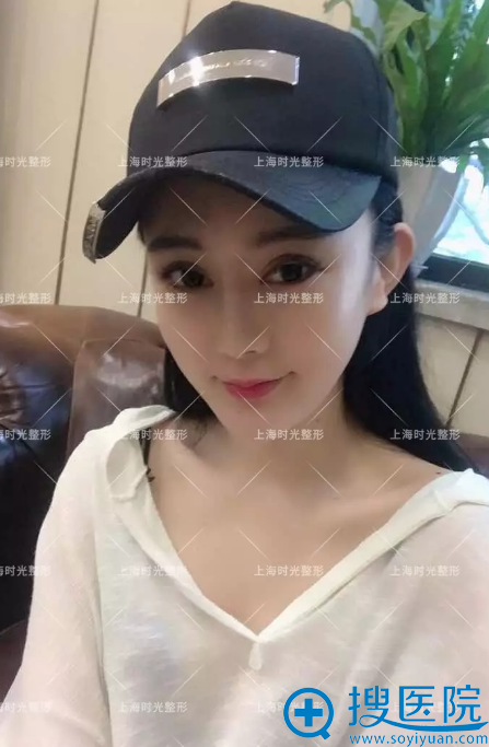 记录表姐7月份找上海时光何晋龙院长做磨骨和下颌角手术全过程