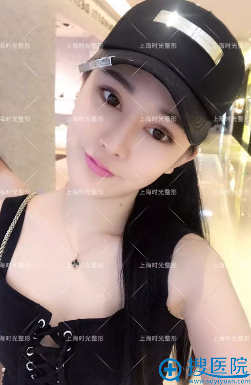 做完磨骨两个月生活照 做完磨骨两个月生活照