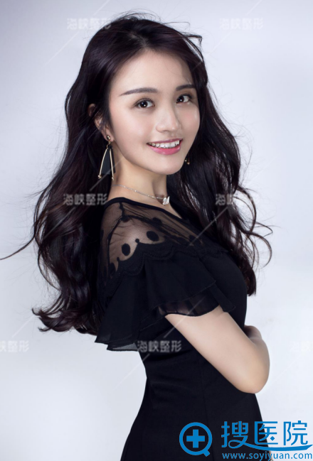 找李丽强主任做完双眼皮41天写真 找李丽强主任做完双眼皮41天写真