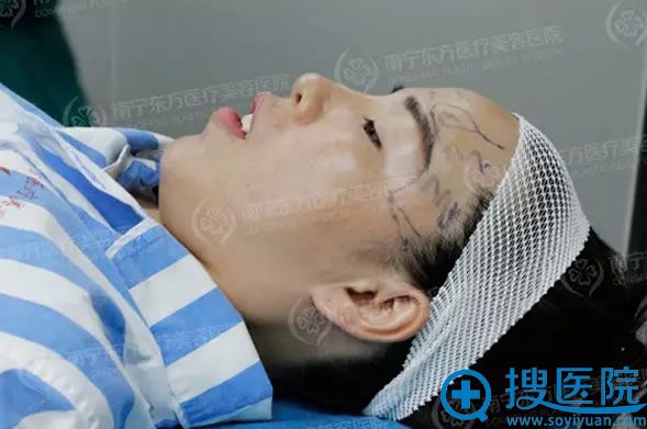 刘刚院长在需要填充的部位进行画线 刘刚院长在需要填充的部位进行画线