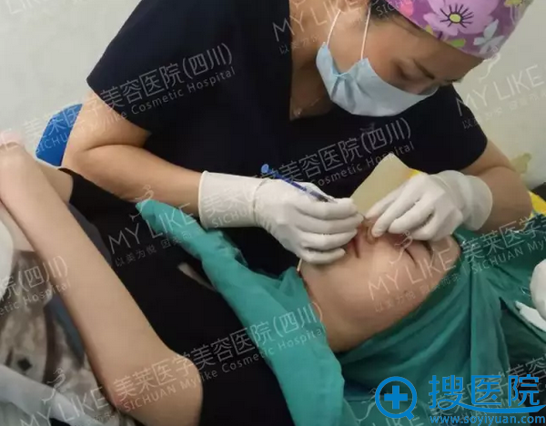 成都做线雕隆鼻哪家好 四川美莱线雕隆鼻+除皱案例效果图分享