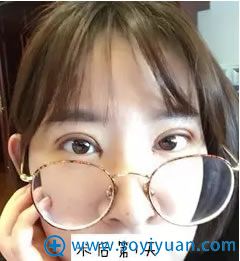 双眼皮术后第1天感觉略微肿胀 双眼皮术后第1天感觉略微肿胀