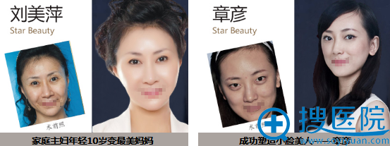 <!--<i data=20240710 data-id=9728></i>-->医疗美容医院整形案例 <!--<i data=20240710 data-id=9728></i>-->医疗美容医院整形案例