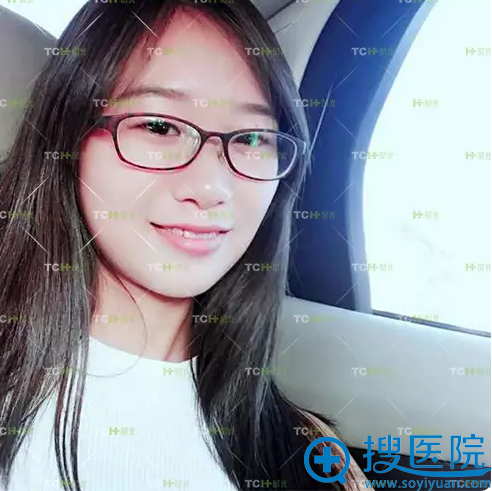 术前戴眼镜生活照 术前戴眼镜生活照