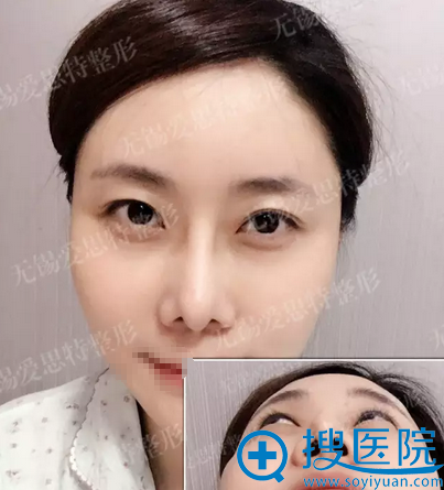 ������˼�أ�ԭ�������죩ŷ����ƽ����¡�ǰ����ָ�Ч��ʵ��