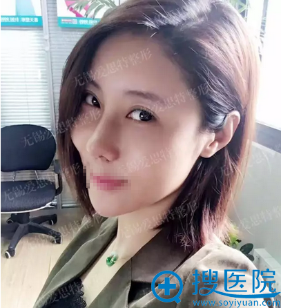 欧阳黎平二次隆鼻修复术后10天恢复情况 欧阳黎平二次隆鼻修复术后10天恢复情况