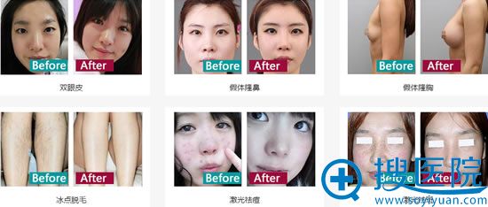 玉林华美整形医院案例效果图 玉林华美整形医院案例效果图