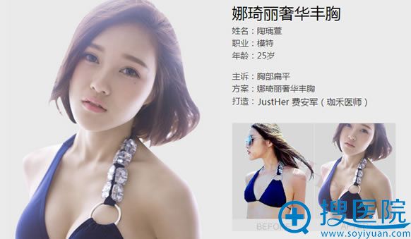<!--<i data=20240710 data-id=10239></i>-->隆胸真人案例图 <!--<i data=20240710 data-id=10239></i>-->隆胸真人案例图