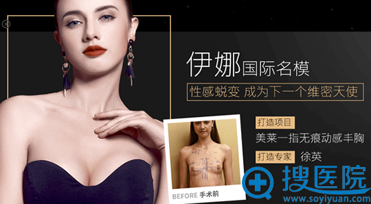 深圳美莱徐英一指无痕动感丰胸案例 深圳美莱徐英一指无痕动感丰胸案例