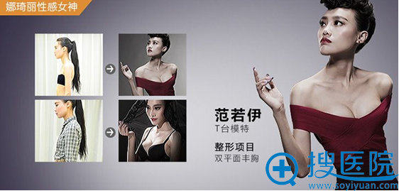 深圳非凡整形美容医院娜绮丽假体丰胸案例 深圳非凡整形美容医院娜绮丽假体丰胸案例