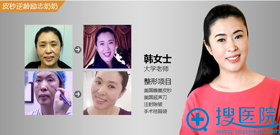 深圳非凡整形美容医院皮肤美容除皱案例 深圳非凡整形美容医院皮肤美容除皱案例