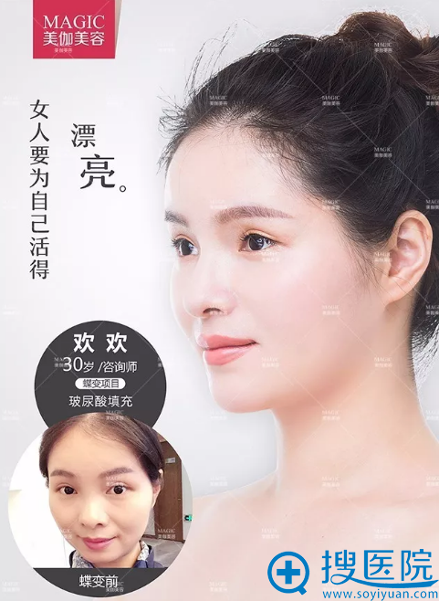 <!--<i data=20240710 data-id=14194></i>-->整形医院玻尿酸填充案例 <!--<i data=20240710 data-id=14194></i>-->整形医院玻尿酸填充案例