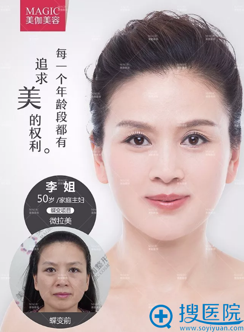 <!--<i data=20240710 data-id=14194></i>-->整形医院微拉美案例 <!--<i data=20240710 data-id=14194></i>-->整形医院微拉美案例