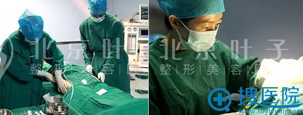 抽取大腿脂肪和填充手术过程 抽取大腿脂肪和填充手术过程