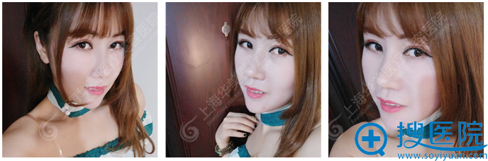 这是现在的我,感谢<!--<i data=20240710 data-id=15924></i>-->医院 这是现在的我,感谢<!--<i data=20240710 data-id=15924></i>-->医院