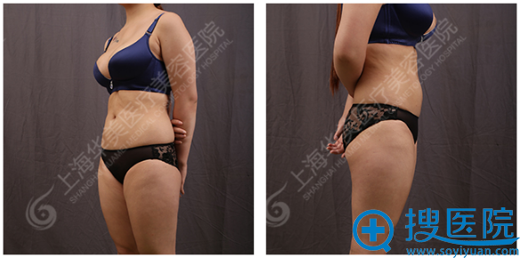 �Ϻ���֬�ļҺ� ���������Ϻ������α����������Ȼ�����������