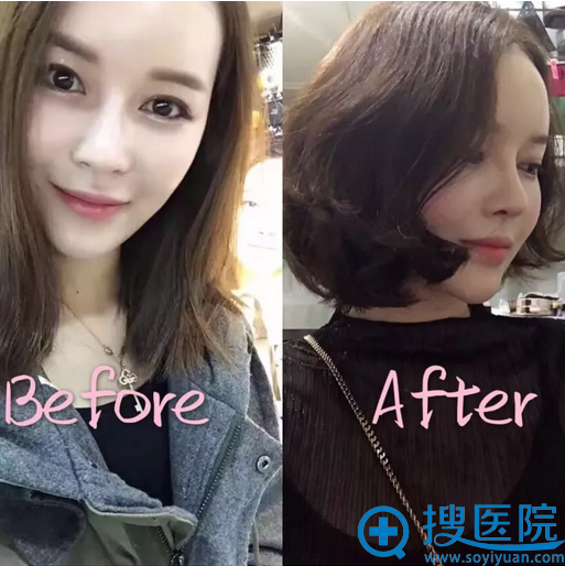 ����bio�Ӷ�������֬�������Ӱ����Ա�ͼ
