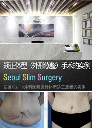 产后肚子松弛怎么办?韩国slim外科腹壁整形术解决肚皮下垂