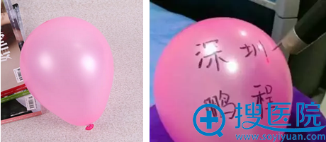 激光祛斑后皮肤会变薄吗?深圳鹏程现场实验视频还原真相