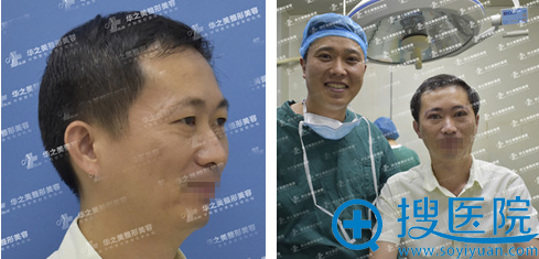 <!--<i data=20240710 data-id=11996></i>-->汪波宇院长全切双眼皮+上睑提肌术前照 <!--<i data=20240710 data-id=11996></i>-->汪波宇院长全切双眼皮+上睑提肌术前照