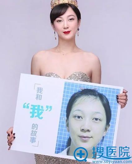 北京艺星双心脸真人案例效果 北京艺星双心脸真人案例效果