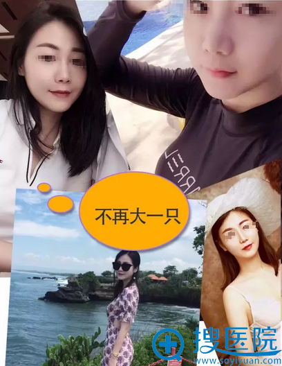 <!--<i data=20240710 data-id=15090></i>-->热拉提去婴儿肥治疗效果 <!--<i data=20240710 data-id=15090></i>-->热拉提去婴儿肥治疗效果