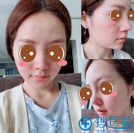 �����ǵ�Ǽ�+����¡������һ�ָܻ�ͼƬ