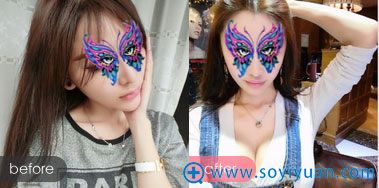 <!--<i data=20240710 data-id=12195></i>-->自体脂肪丰胸效果 <!--<i data=20240710 data-id=12195></i>-->自体脂肪丰胸效果
