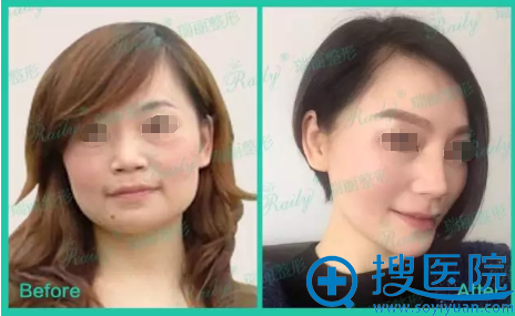 �沿����ǰ��Ա���