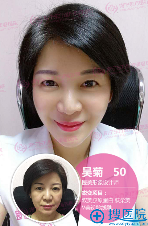 南宁哪里的线雕好?东方整形医院全脸线雕提升案例效果图分享